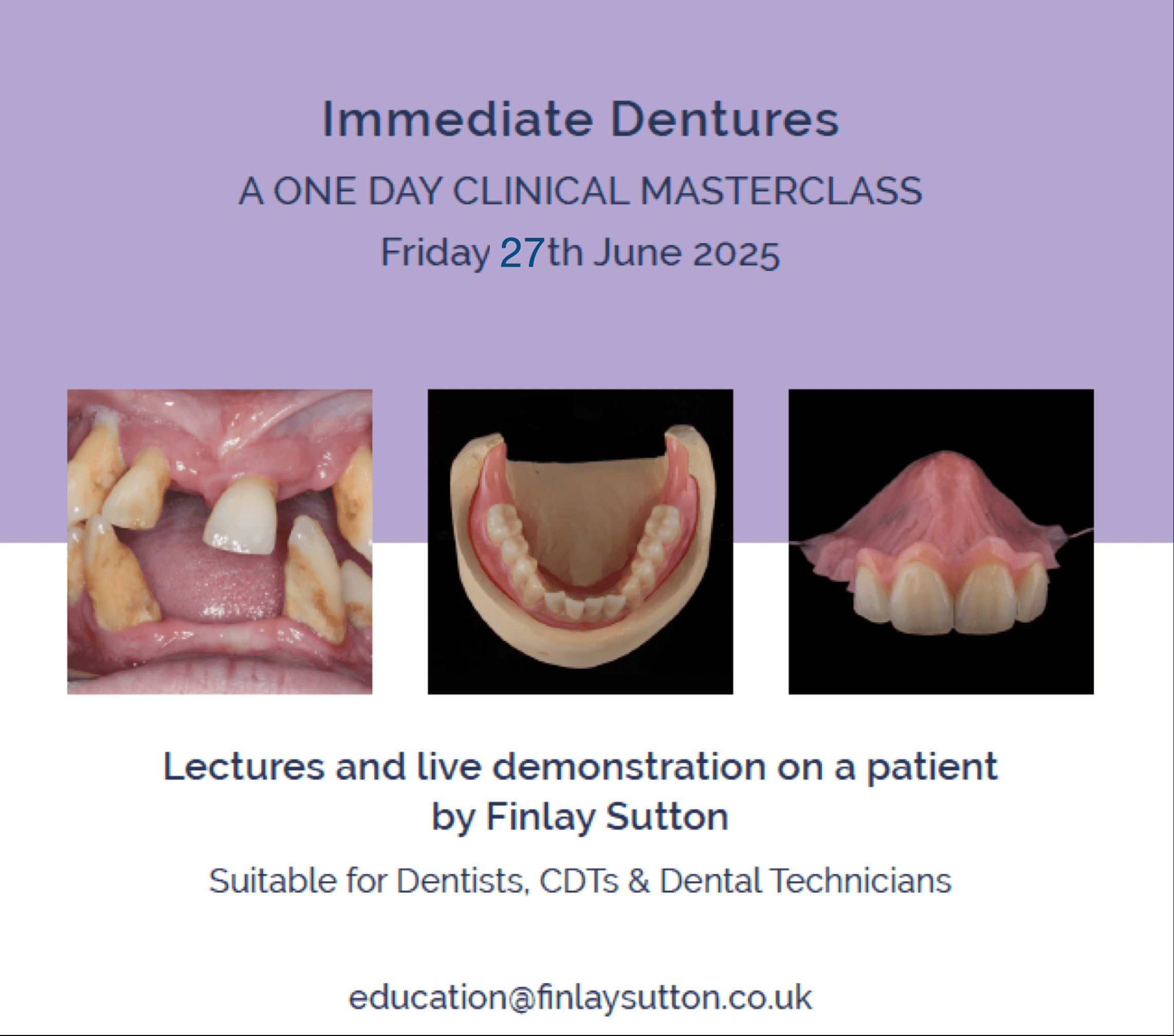Immediate Denture Course Friday 26 June 2026